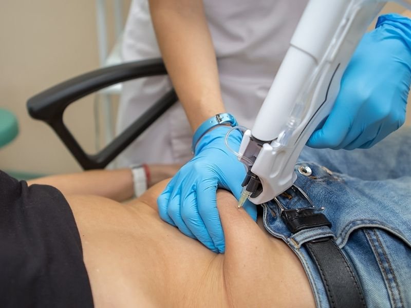 Bölgesel Zayıflama Nedir? Gerçekçi Bir Bakış